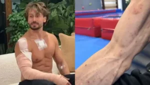 Tiger Shroff hits back at trolls by showing his injury marks; he was indeed hurt in a life-threatening attack.